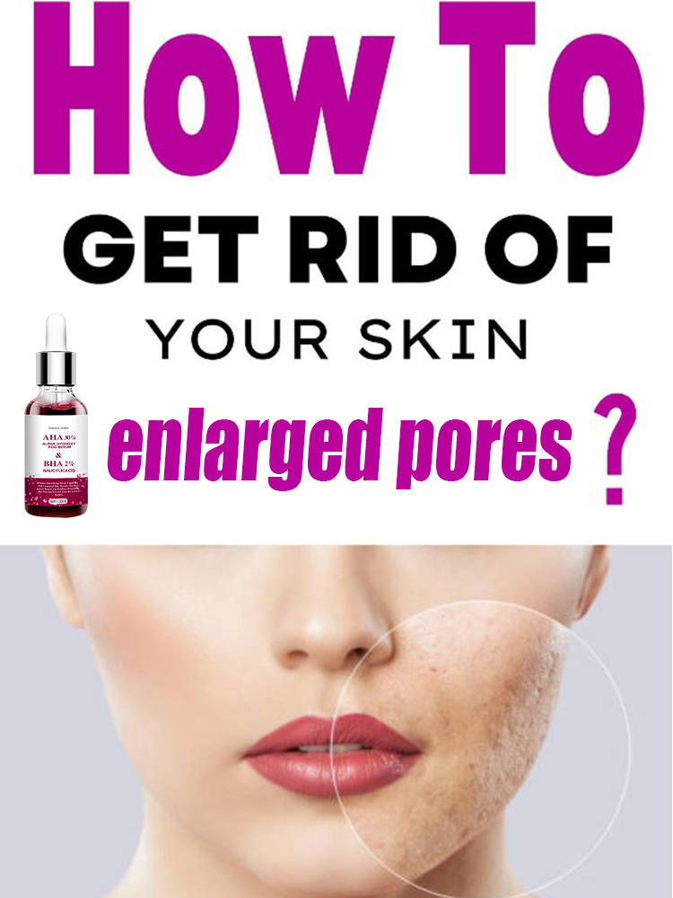 Salicylic Acid Blackhead Remover - Encolher poros soro salicílico ácido de