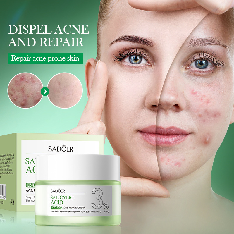 Salicylic Acid Blackhead Remover - Creme de Tratamento para Acne com
