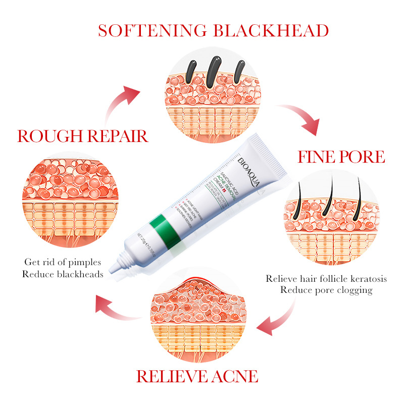 1/2/3 pçs bioaqua ácido salicí - Salicylic Acid Blackhead Remover avaliação e preço