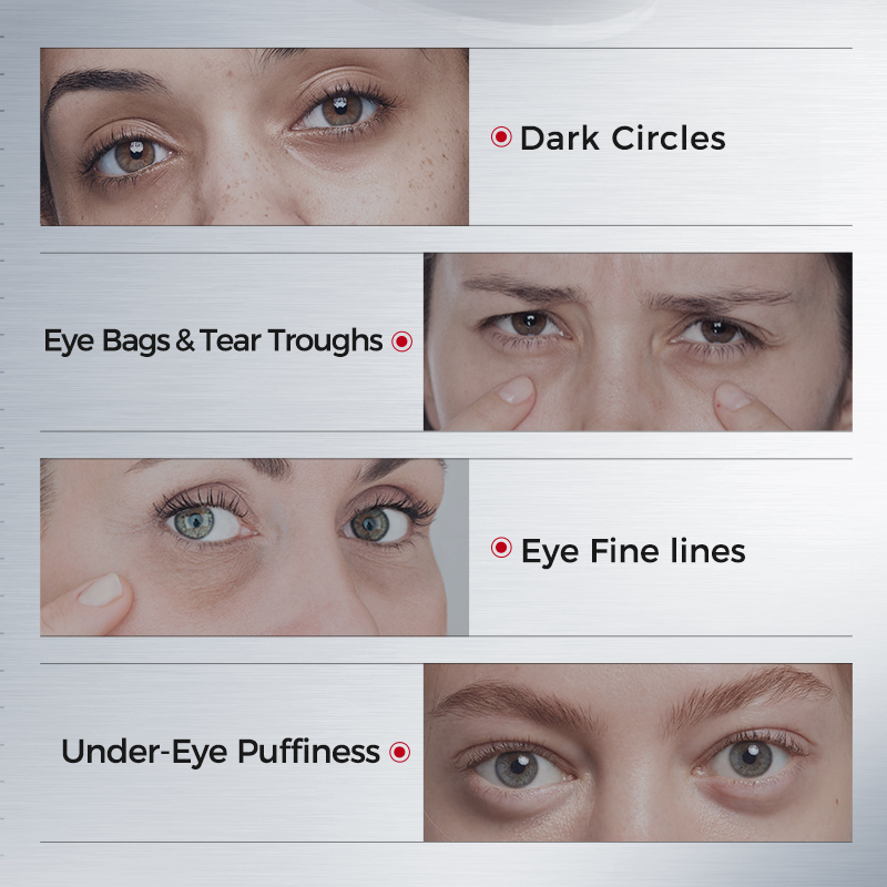 Patches para Olheiras – Firmad - Collagen Under Eye Patches avaliação e preço