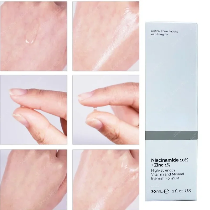 Niacinamida magnésio clareamen - Niacinamide Pore Shrinking Essence avaliação e preço