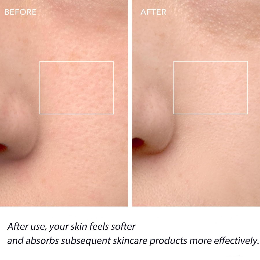 Escova de Limpeza Facial, Esfo - Silicone Face Scrubber Electric avaliação e preço