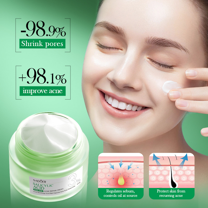 Creme de Tratamento para Acne  - Salicylic Acid Blackhead Remover avaliação e preço