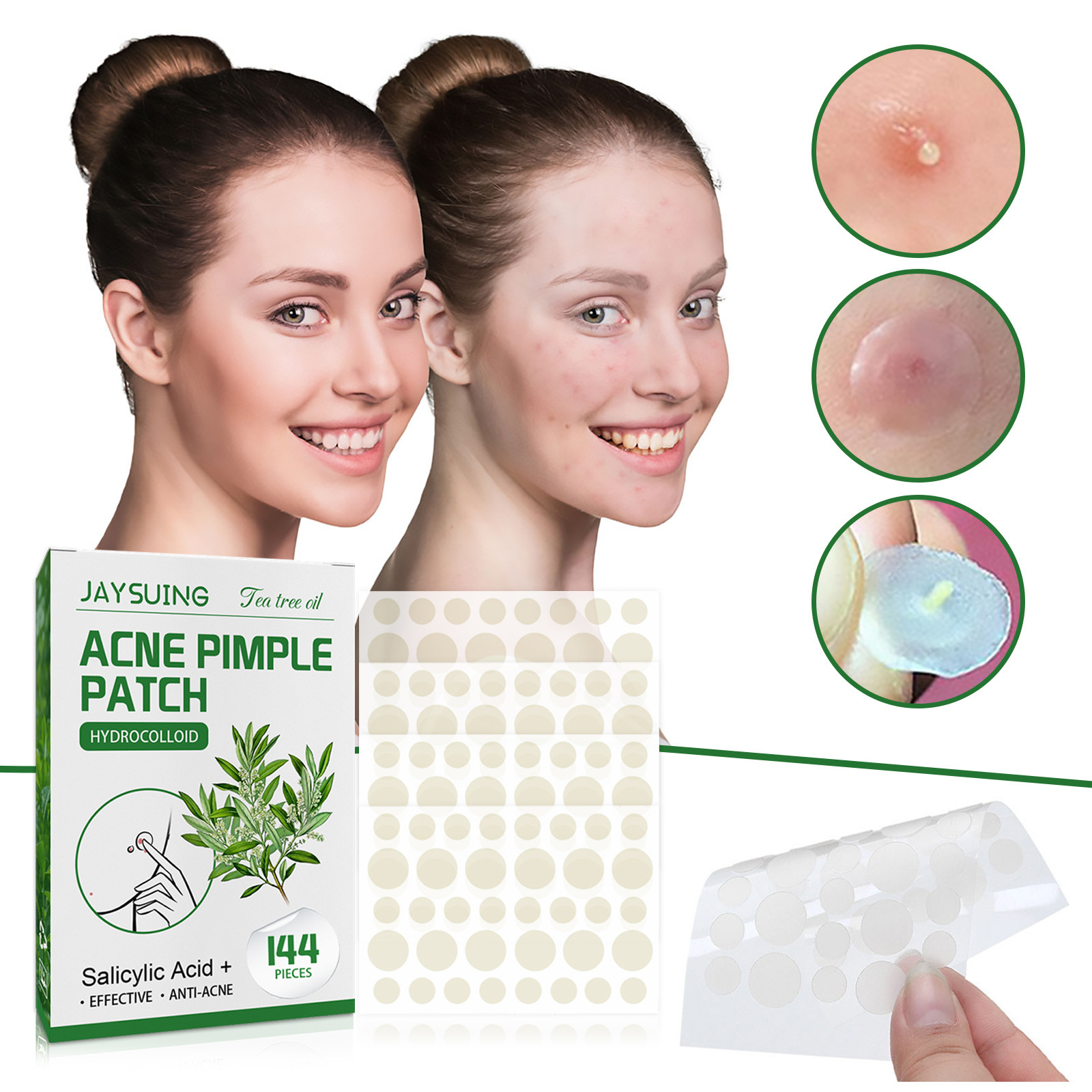 Patches hidrocolóides para acn - Hydrocolloid Pimple Patch avaliação e preço