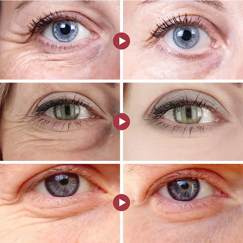 Rugas remover os olhos remendo - Collagen Under Eye Patches avaliação e preço