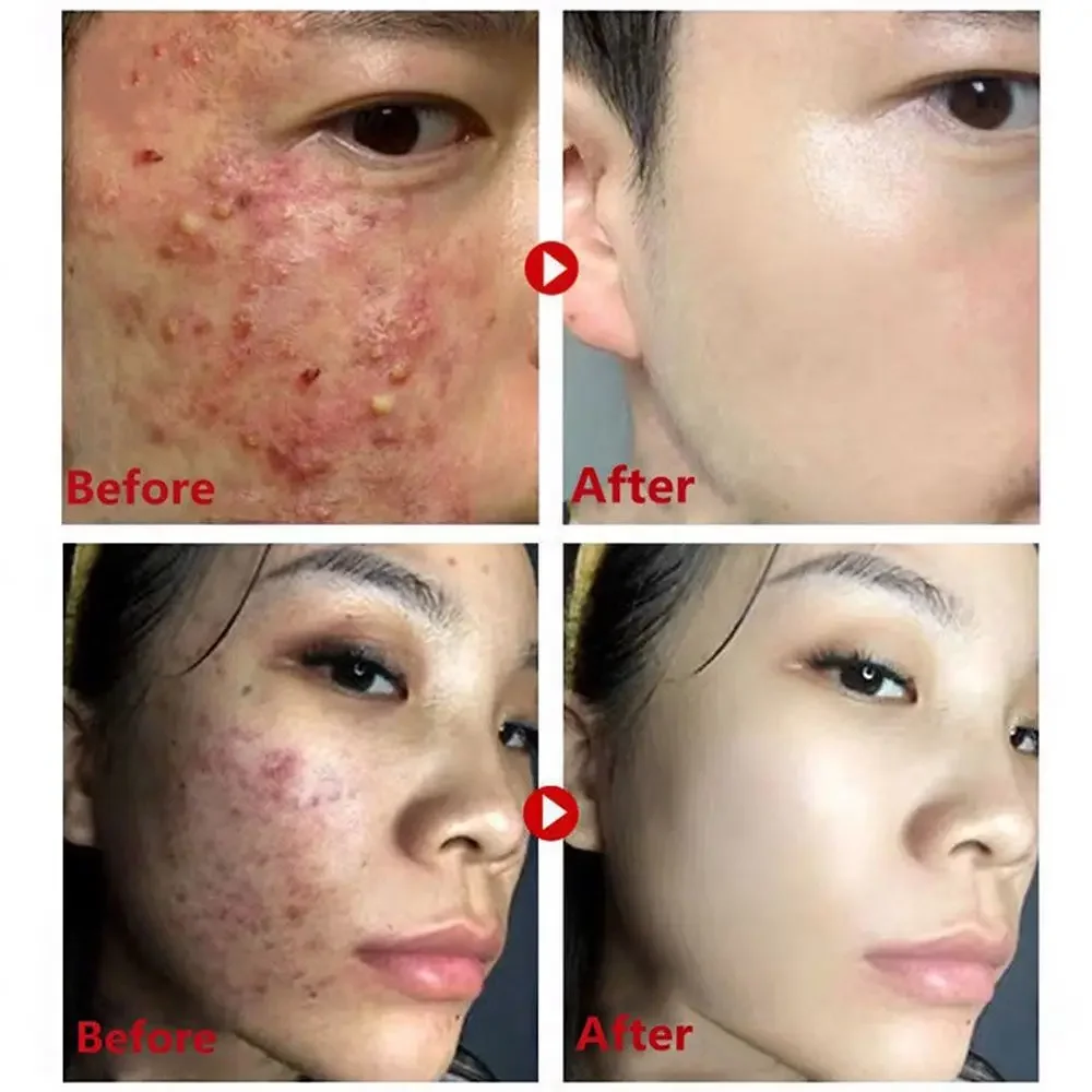 Vara de máscara de chá verde p - Green Tea Cleansing Clay Mask avaliação e preço