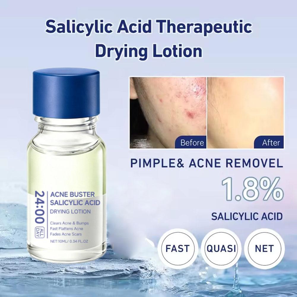 Ácido Salicílico Removedor de  - Salicylic Acid Blackhead Remover avaliação e preço